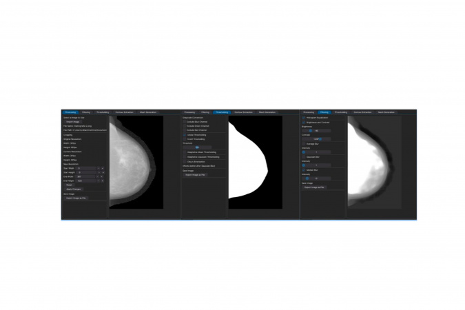 Software desenvolvido na UEL avalia progressão e tratamento do câncer de mama