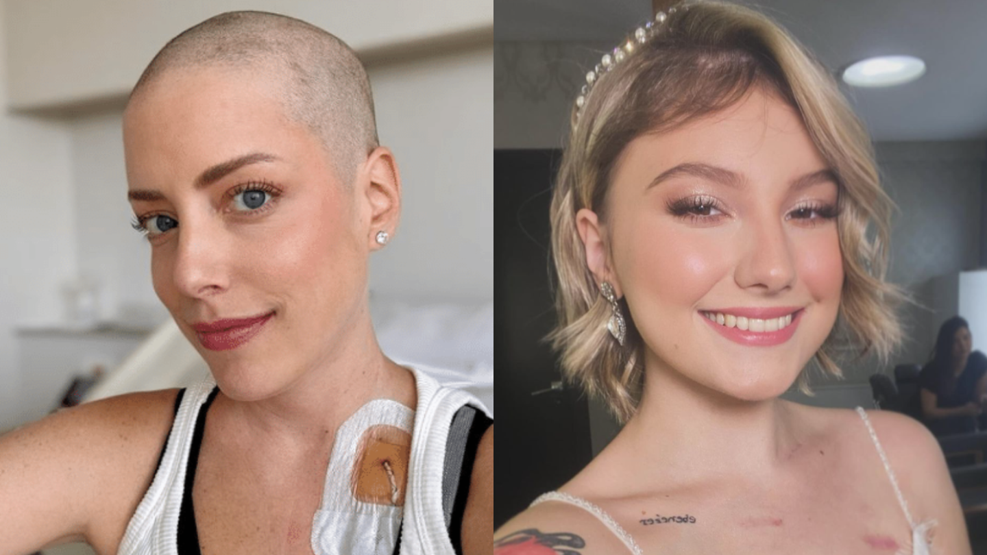 O que é mucosite, complicação de Fabiana Justus e Isabel Veloso em tratamento de câncer