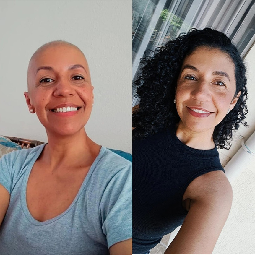 Antes e depois: a professora Valquíria Correa, de 46 anos, descobriu um nódulo por um autoexame confirmado com uma mamografia e passou pelo tratamento da quimio e radioterapia.