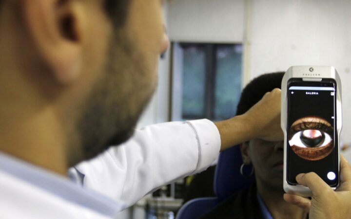 Retinopatia: doença ocular afeta um em cada três diabéticos